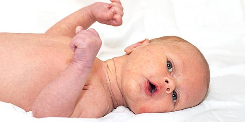 Understanding Torticollis in Newborns: Causes and Solutions
